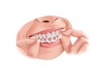 Maxicare Dental
